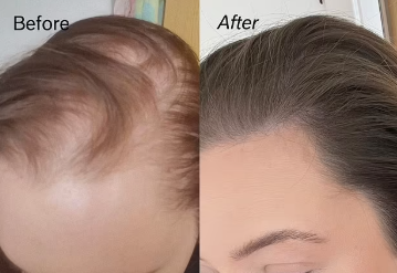 Divi Scalp Serum