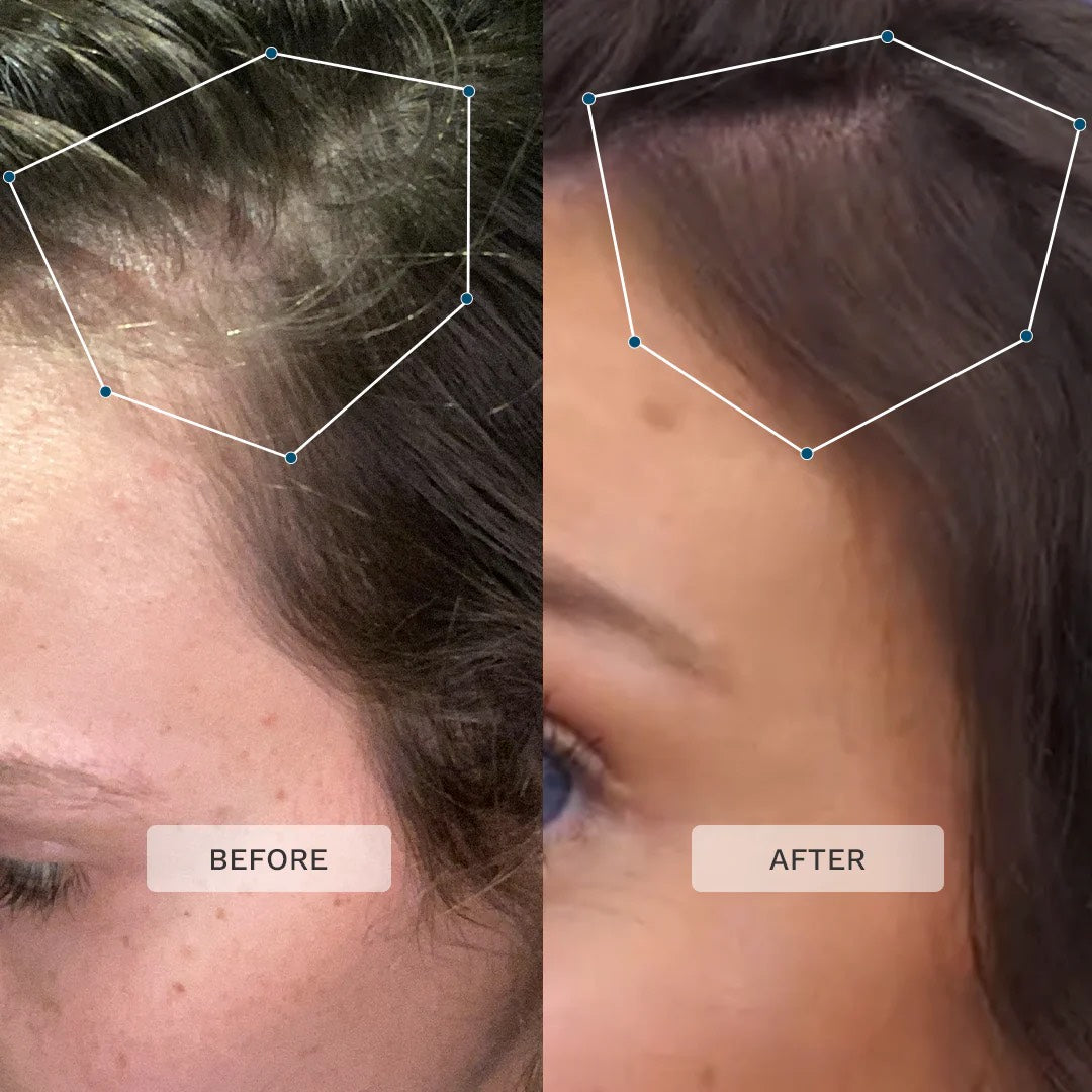 Divi Scalp Serum