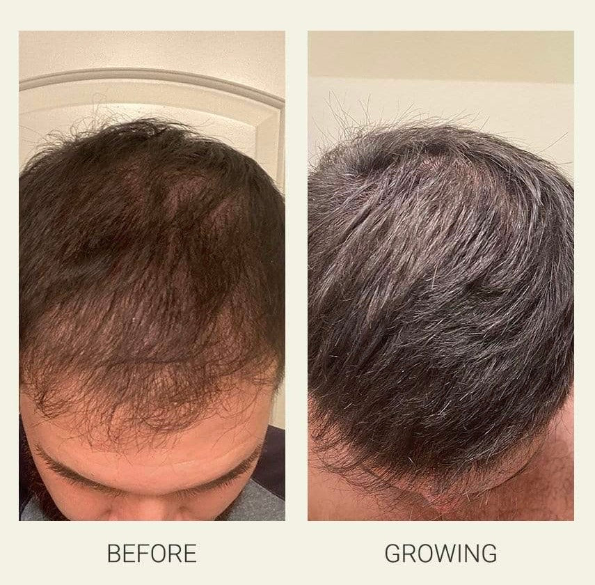 Divi Scalp Serum